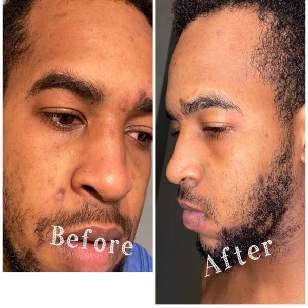 Byenblan Turmeric Face Cream 4oz Dark Spot Care - WorldcaShop Usa - Image 7